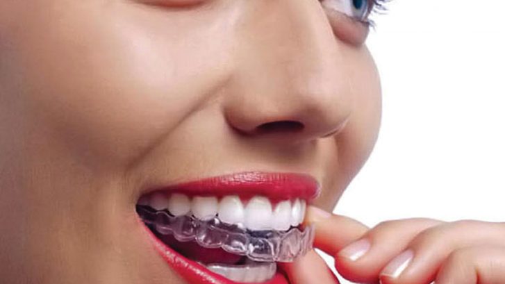 Invisalign Tedavisi Uzmanı / Doktoru