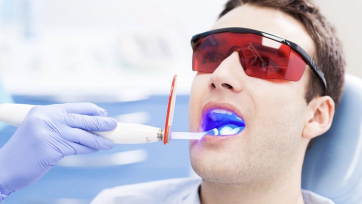 Lazer İle Diş Beyazlatma Nedir? Nasıl Yapılır?